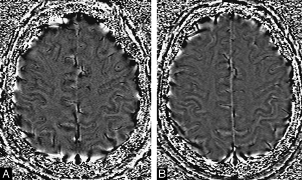 Fig 10.