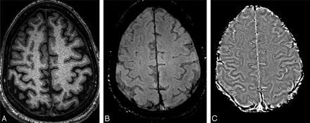 Fig 4.