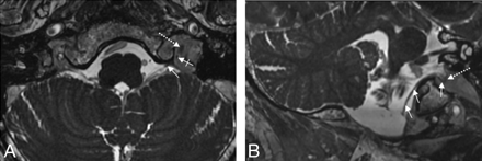 Fig 3.