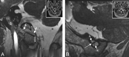 Fig 6.