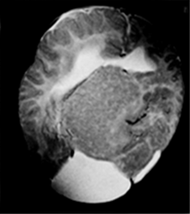 Fig 10.
