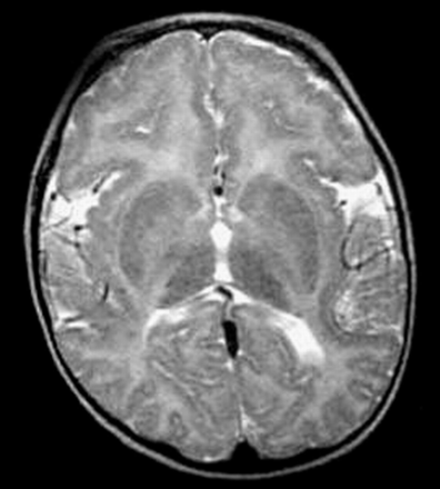 Fig 11.