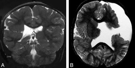 Fig 12.