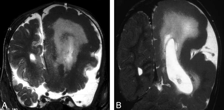 Fig 2.