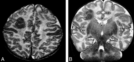 Fig 3.