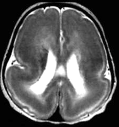 Fig 4.