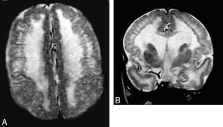 Fig 5.