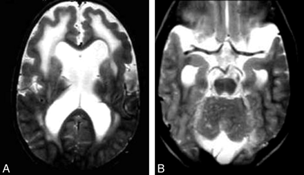 Fig 7.