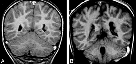 Fig 8.