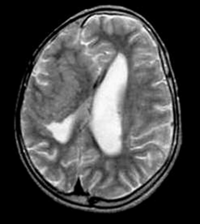 Fig 9.