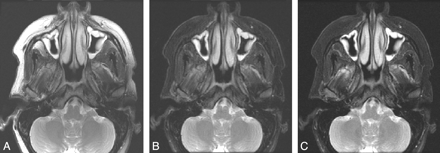 Fig 1.