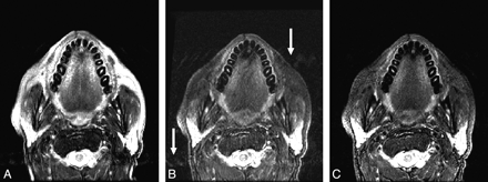 Fig 3.