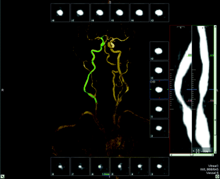 Fig 3.
