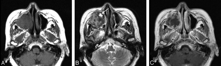 Fig 1.