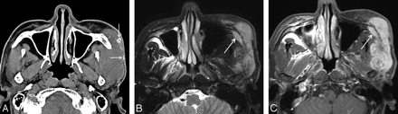 Fig 2.