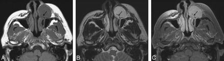 Fig 3.