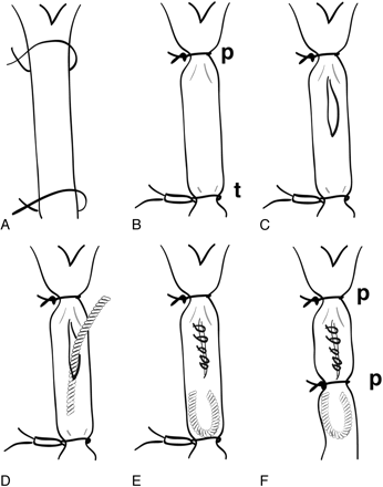 Fig 1.