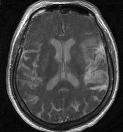   Fig 1. 