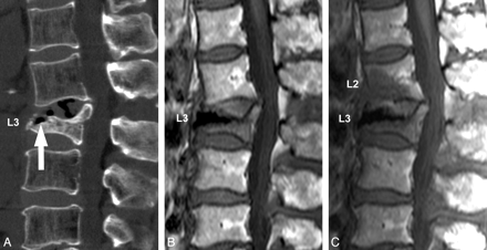 Fig 1.