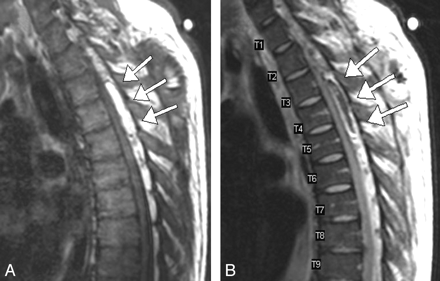 Fig 1.