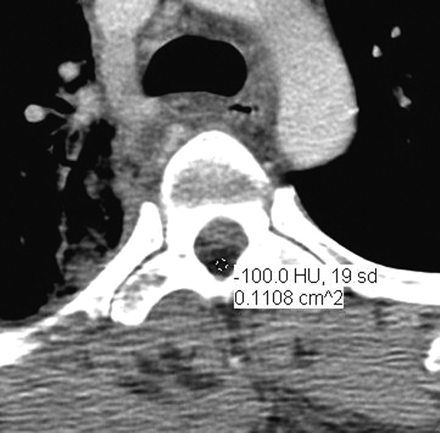 Fig 3.