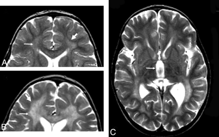 Fig 1.