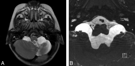 Fig 2.