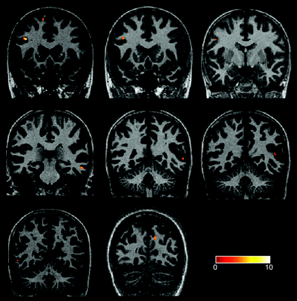 Fig 2.