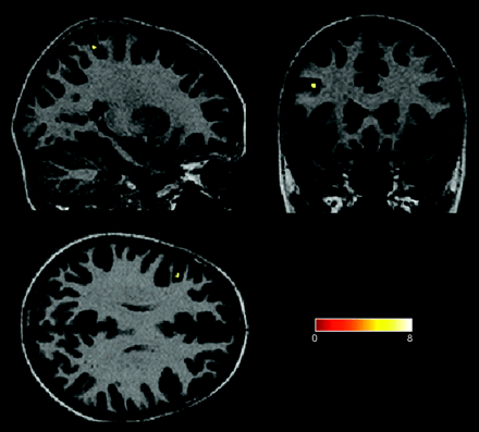Fig 3.