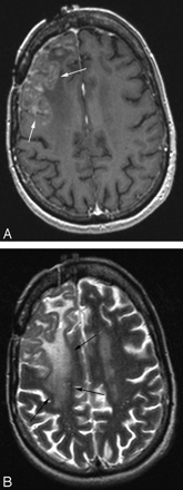 Fig 2.