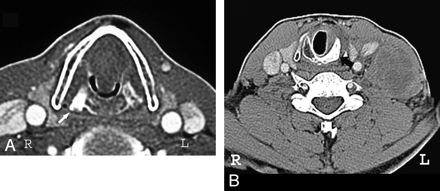 Fig 1.
