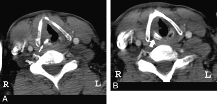 Fig 2.