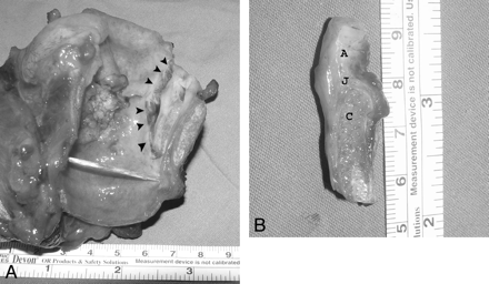 Fig 3.