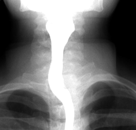 Fig 2.