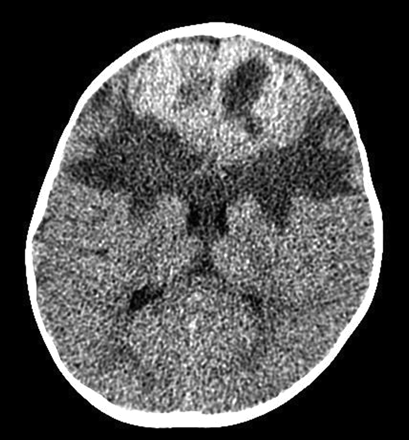 Fig 1.