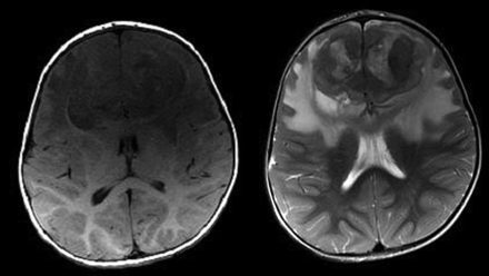 Fig 2.