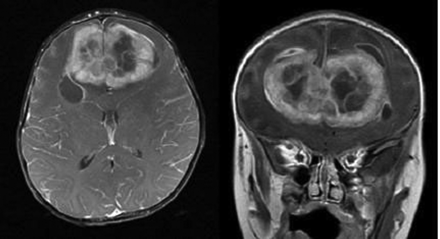 Fig 3.