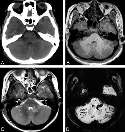Fig 1.