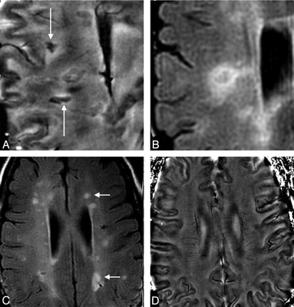 Fig 10.