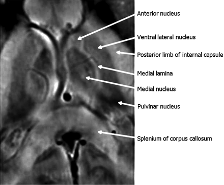 Fig 13.