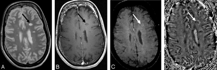 Fig 14.