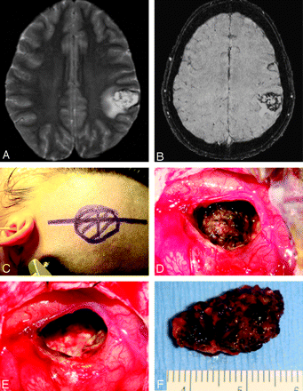 Fig 15.