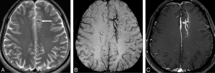 Fig 16.