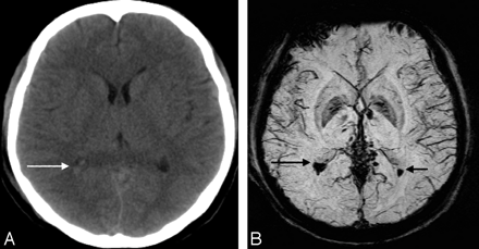 Fig 2.