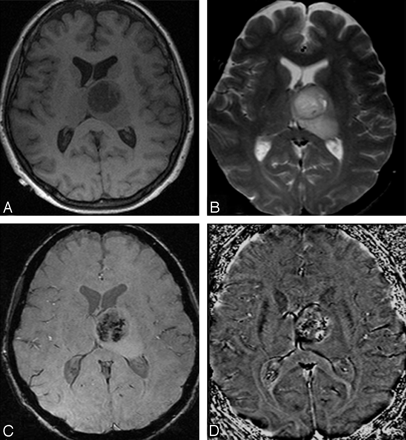 Fig 23.