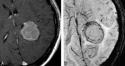 Fig 24.
