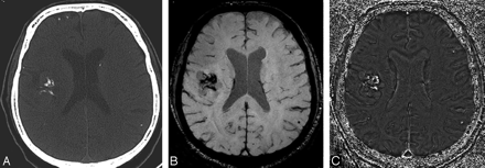 Fig 26.