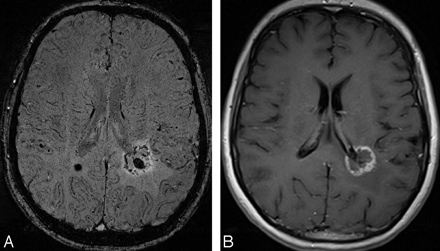 Fig 27.