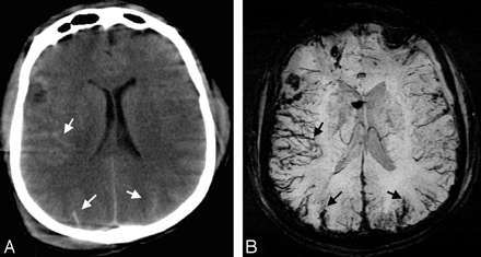 Fig 3.