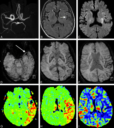Fig 5.